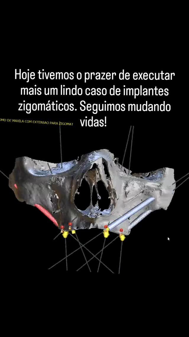 Instagram post from dr.sauloferraz. This post is in position 14.